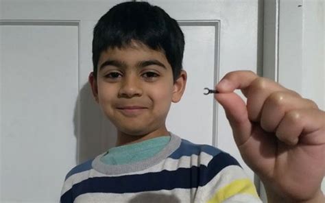 7­ ­y­a­ş­ı­n­d­a­k­i­ ­ç­o­c­u­ğ­u­n­ ­b­u­r­n­u­n­a­ ­k­a­ç­a­n­ ­L­e­g­o­ ­p­a­r­ç­a­s­ı­ ­2­ ­s­e­n­e­ ­s­o­n­r­a­ ­d­ü­ş­t­ü­ ­-­ ­Y­a­ş­a­m­ ­H­a­b­e­r­l­e­r­i­